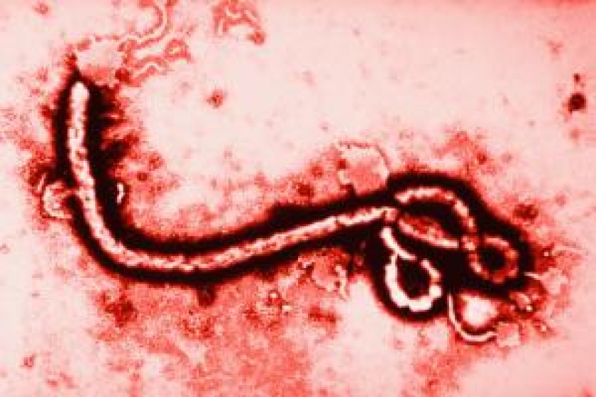 The Ebola virus at 108,000 times magnification.